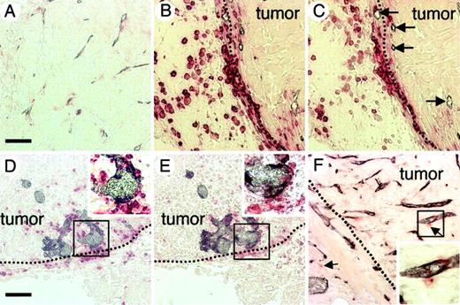 Figure 4. Localization of HCs in PC3 tumor tissues. (A-E) Sections of PC3 tumor tissues from PC3 tumors with a volume of (A) more than 500 mm3, (B-C) 60 to 70 mm3, and (D-E) 100 to 120 mm3 were double stained with anti–PECAM-1 mAb (dark blue) and anti-CD45 mAb (red) (A,B,D) or with anti–PECAM-1 mAb (dark blue) and anti–c-Kit mAb (red) (C,E). Arrows in panel C indicate a small capillary at the tumor edge. Panels C,E are serial sections of panels B,D, respectively. (F) Colon26 tumor tissue section from a tumor with a volume of 60 to 70 mm3 was stained with anti–PECAM-1 mAb (dark blue) and anti–c-Kit mAb (red). Arrows indicate cells that are positive for c-Kit. The dotted line (B-F) shows the border between the fibrous cap surrounding the tumor mass and the tumor mass. Insets (D-F) show high-power views of the area indicated by box. The bar in panel A indicates 50 μm (A-C). The bar in panel D indicates 100 μm (D-F).