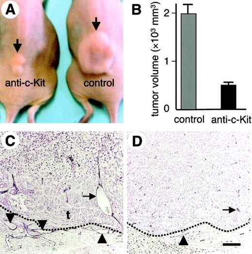 Figure 6. Suppression of tumor angiogenesis in PC3 tumor mass by anti–c-Kit mAb. The anti–c-Kit mAb, ACK2, was injected for 4 days (1 mg/d per mouse) into nude mice as described in the legend to Figure 3. (A) Photographs of mice taken 14 days after inoculation with PC3 cells. Arrows indicate the tumor mass in mice that had been treated with ACK2 (anti–c-Kit) or anti-B220 mAb (control). (B) Tumor volume on day 14 in mice that had been treated with ACK2 (anti–c-Kit) or anti-B220 mAb (control). The tumor volumes measured on day 14 were 486 ± 53 mm3 (ACK2: n = 8), and 1927 ± 258 mm3 (B220: n = 8). Results are expressed as the mean volume of 8 experiments (± SEM). (C-D) Tissue sections of the tumors from the mice observed in panel A, stained with anti–PECAM-1 mAb and counterstained with fast red. Tissue sections of the tumors from mice that had been injected with anti-B220 mAb (C) or ACK2 (D) are shown. The dotted line shows the border between the fibrous cap surrounding the tumor mass and the tumor mass. The area above the dotted line is the tumor mass. Arrow indicates a capillary that migrated into the tumor. The arrowheads show a vascular bed observed in the fibrous cap surrounding the tumor mass. Bar indicates 150 μm in panels C,D.