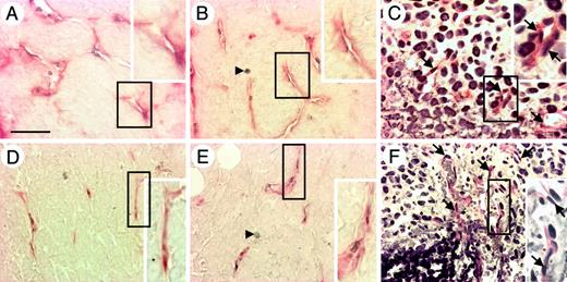 Figure 7. Analysis of the survival and migration of ECs into tumor tissues after injection of anti–c-Kit mAb in tumor-bearing mice. Colon26 tumor cells (A-C) or PC3 tumor cells (D-F) were subcutaneously inoculated into mice. Then, anti-B220 control mAb (A,D), anti–c-Kit mAb (B,E), or CPM (C,F) was injected into the mice. Anti-B220 mAb or anti–c-Kit mAb (1 mg/d per mouse) was injected daily from day 2 to day 5 after inoculation of tumor cells, and CPM (170 mg/kg per single injection) was injected on day 0 and day 6. Tumors were dissected on day 7. Sections were stained with anti–PECAM-1 mAb (red) and were subsequently analyzed for the presence of apoptotic cells by the TUNEL assay (dark blue). Arrowheads in panels B,E indicate round, apoptotic cells, and arrows in panels C,F indicate ECs. The inset in each panel shows a high-power view of the area indicated by the box. Bar in panel A indicates 40 μm in panels A-C and 60 μm in panels D-F.
