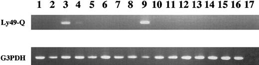Figure 5. Ly49Q expression in various tissues examined by RT-PCR. Lane 1, heart; lane 2, brain; lane 3, spleen; lane 4, lung; lane 5, liver; lane 6, skeletal muscle; lane 7, kidney; lane 8, testis; lane 9, bone marrow; lane 10, eye; lane 11, lymph node; lane 12, smooth muscle; lane 13, prostate; lane 14, thymus; lane 15, uterus; lane 16, stomach; and lane 17, no template.