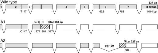 Figure 2. Genomic organization of the human normal wild-type and the patient A1 and A2 transcripts of the CMP–sialic acid transporter gene. The A1 allele contains a 147T>C substitution and 2 microdeletions (G277 and C281) that generate a frameshift (▨) and the appearance of a premature stop codon at position 327. The A2 allele has a 130-bp deletion covering two thirds of exon 6 and generating also a frameshift (▨) and a premature stop codon at position 684.