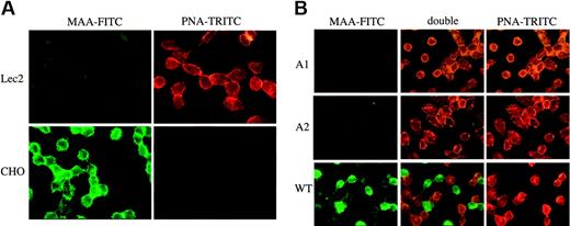 Figure 7. Fluorescent staining with PNA and MAA lectins of CHO, Lec2, and complemented Lec2 cells with the 2 patient alleles. (A) All cells are MAA– and PNA+ in the Lec2 cell line (expression of nonsialylated precursor). Unlike this, the opposite phenotype is seen with the parental CHO cell line, where all cells are MAA+ and PNA– (expression of α2,3-sialylated epitope). (B) Complementation of Lec2 with wild-type CMP–sialic acid transporter gene and lack of complementation with either of the A1 or A2 patient's cDNA alleles. The transduction efficiency was of about 50% as illustrated by the MAA-FITC staining of half of the cells transduced with the normal human wild-type transcript. Left, fluorescein-labeled MAA; right, rhodamine-labeled PNA; middle, superimposition of the green and red pictures. A complete change of phenotype (from MAA–, PNA+ to MAA+, PNA–) can be seen in the transducted cells.