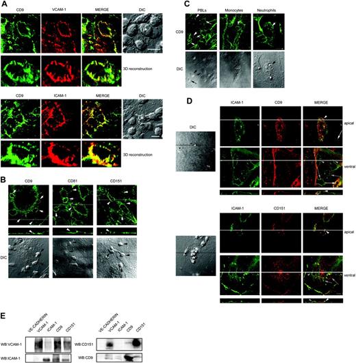 Figure 1. Endothelial tetraspanin proteins relocalize to the contact site with adherent leukocytes and associate with ICAM-1 and VCAM-1. (A) T lymphoblasts were adhered to TNF-α–activated HUVEC monolayers, fixed, and double-stained for CD9 and VCAM-1 or ICAM-1. Maximum projections of the relevant sections from the confocal stacks and the merge of both channels are shown. Asterisks in differential interference contrast (DIC) images highlight the T lymphoblasts around which the docking structures shown in the 3-dimensional (3D) reconstructions are formed. Scale bars equal 10 μm. (B) T lymphoblasts were adhered to TNF-α–activated HUVEC monolayers, fixed, and stained with antitetraspanin mAbs VJ1/20 (anti-CD9), I.33.2.2 (anti-CD81), and LIA1/1 (anti-CD151). Confocal stacks were obtained and representative apical horizontal and vertical sections together with the corresponding DIC images are shown. Arrows point to the positions of the adhered lymphoblasts. Arrowheads and lines point to the position of the adhered lymphoblasts shown in the vertical sections. Scale bar equals 10 μm. (C) Human PBLs, neutrophils, or monocytes were perfused at physiologic flow rate (1.8 dyn/cm2), fixed, and stained with anti-CD9 VJ1/20 mAb. Confocal stacks were obtained and maximum projections of the whole series or a representative section together with the corresponding DIC images are shown. Arrows point to the position of the adhered leukocytes. Scale bar equals 20 μm. (D) Analysis of the localization of endogenous endothelial CD9 or CD151, compared with ICAM-1, at apical and ventral contact sites with transmigrating lymphocytes. Human T lymphoblasts were allowed to transmigrate through TNF-α–activated HUVECs, fixed, and double-stained with antitetraspanin mAbs and biotin-conjugated anti–ICAM-1. Confocal stacks were obtained and representative sections at apical or ventral positions of the same field together with the corresponding DIC image are displayed. White arrows and asterisks mark apically adhered lymphocytes, and gray arrows and black asterisks mark those lymphocytes that have transmigrated. Arrowheads and lines point to the position of the adhered or transmigrated lymphoblast shown in the vertical sections. Scale bar equals 10 μm. (E) ICAM-1 and VCAM-1 are associated with tetraspanins in TNF-α–activated HUVECs. Cell lysates were obtained in 1% Brij96 and immunoprecipitated with the different mAbs specific for endothelial adhesion molecules or tetraspanins. After washing, immunoprecipitates were resolved in sodium dodecyl sulfate–polyacrylamide gel electrophosphoresis (SDS-PAGE) gels and revealed by Western blot for VCAM-1 (P8B1), ICAM-1 (HU5/3), CD151 (8C3) or CD9 (VJ1/20).