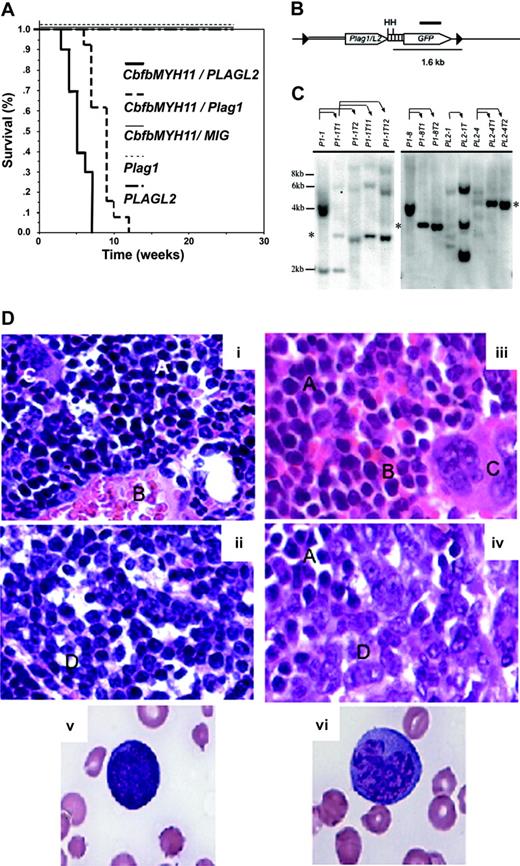 Figure 2. Plag1 and PLAGL2 cooperate with Cbfb-MYH11 to induce AML in mice. (A) Kaplan-Meier survival curve of mice that received transplants with bone marrow cells expressing: Cbfb-MYH11 and MIG-Plag1 (thick dashed line), Cbfb-MYH11 and MIG-PLAGL2 (thick solid line), Cbfb-MYH11 and MIG (thin solid line), MIG-Plag1 (thin dashed line), or MIG-PLAGL2 (dotted-dashed line). (B) Representation of the MIG-Plag1/L2 provirus. The LTRs (▸), coding sequence for Plag1/L2 (sequence encoding Plag1 or PLAGL2) and GFP (open arrows), internal ribosome entry site (IRES; ▥), probe (thick line), HindIII restriction sites (H), genomic (thin line) and viral (double thin line) sequences, are detailed. (C) Representative Southern blot analysis of transplantation of leukemic cells. DNA from PLAG-associated primary leukemia (lanes 1, 6, 9, 11), secondary transplanted leukemias (lanes 2, 3, 7, 8, 10, 12, 13), and tertiary transplanted leukemias (lanes 4 and 5) were probed with the retroviral GFP sequence. Thin arrows indicate which primary leukemic cells were used for secondary and tertiary transplants. Asterisk shows a band that represents the clonal expansion of a population of leukemic cells that became predominant in mice that receive transplants. The expected molecular weight of expected fragments (in kb) is indicated at the left. (D) Pathologic characteristics of leukemic cells. Wright-Giemsa staining of (× 10 magnification) normal (panel i) and leukemic (panel iii) bone marrow, normal (panel ii) and leukemic spleen (panel iv), and representative blastlike (panel v) and monocytic-like (panel vi) cells (× 100 magnification). Note area with lymphoid (A), red (B), megakaryocytes (C), and leukemic (D) cells.