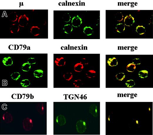 Figure 2. Analysis of the subcellular localization of the various BCR components by immunofluorescence microscopy. Fixed and permeabilized CLL B cells were incubated with various combinations of mAbs as follows: anti-μ/anticalnexin (A), anti-CD79a/anticalnexin (B), and anti-CD79b/anti-TGN46 (C). Red and green images were collected and merged, with yellow coloration indicating colocalization. These images were obtained with B cells from patient 2 (Table 1).