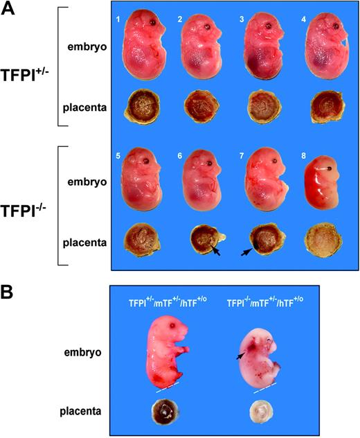 Figure 1. Analysis of TFPI–/– embryos and placentas. (A) We observed 4 TFPI+/– embryos (nos. 1-4) and 4 TFPI–/– embryos (nos. 5-8) at E14.5 from the same litter in a cross between TFPI+/– mice. Embryos 1 to 7 were alive and embryo 8 was dead. Hemorrhages were observed on the surface of placentas no. 6 and no. 7 (arrows) and placenta no. 8 was white. (B) Two E15.5 embryos. The TFPI+/–/mTF+/–/hTF+/o embryo and placenta was normal, whereas the TFPI–/–/mTF+/–/hTF+/o embryo was growth-retarded with signs of hemorrhage (arrow) and had a white placenta. The lower leg and/or tail were removed for genotyping (dashed line).