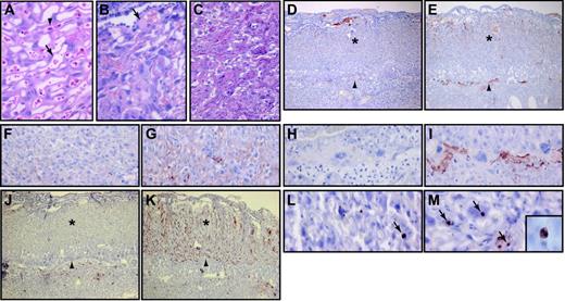 Figure 2. Histologic analysis of TFPI–/– placentas. E14.5 placentas from wild-type (A), as well as live (B) and dead (C) TFPI–/– embryos were analyzed by H&E. Embryonic nucleated red blood cells (arrowhead) and maternal red blood cells (arrow) were observed in the wild-type placenta. The placenta of the live TFPI–/– embryo contained thrombi within the labyrinthine zone (arrow). The labyrinthine zone of the placenta of the dead TFPI–/– embryo was disrupted. Fibrin staining of placentas of TFPI+/– (D, F, H) and the dead TFPI–/– (E, G, I) embryos. TUNEL staining of apoptotic cells in placentas of TFPI+/– (J, L) and the dead TFPI–/– embryo (K, M). Arrowheads (D-E, J-K) indicate the trophoblast giant cell layer.Asterisks (D-E, J-K) indicate the labyrinthine zone. Arrows in panels L and M indicate TUNEL-positive cells. Original magnification, × 40 (D-E, J-K), × 400 (A-C, F-I, L-M), and × 1000 (inset in panel M showing nuclear condensation in a TUNEL-positive apoptotic cell).