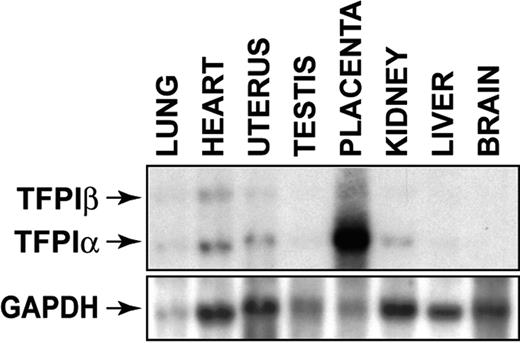 Figure 3. Tissue distribution of TFPIα and TFPIβ mRNAs in mouse tissues. Levels of TFPIα and TFPIβ mRNAs in various tissues were determined by Northern blotting using 10 μg RNA for each tissue. Loading was assessed by reprobing the blot with a GAPDH probe. TFPIα mRNA is 1.3 kb and TFPIβ mRNA is 4.0 kb.