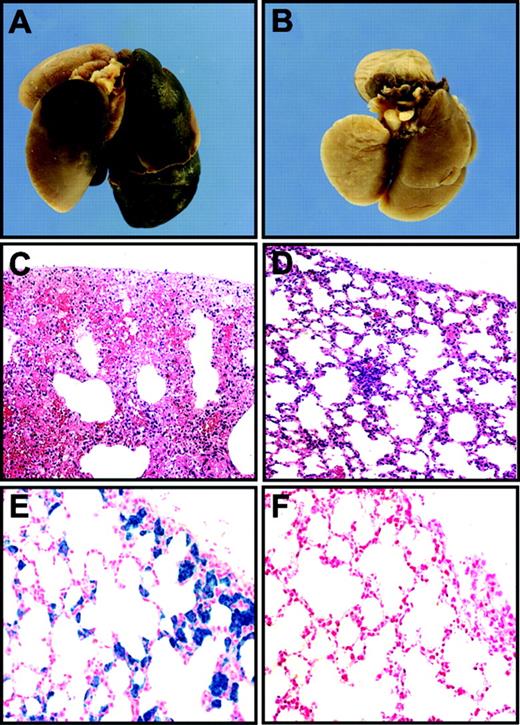 Figure 6. Analysis of lungs of low-TF mice with different levels of TFPI. Low-TF mice with wild-type levels of TFPI frequently died of lung hemorrhages (A, C) and also had hemosiderin deposition in their lungs (E). In contrast, no hemorrhages or hemosiderin deposits were observed in lungs of low-TF mice with no TFPI (B, D, F). Panels A and B show macroscopic views of lungs. Panels C and D were stained with H&E. Panels E and F were stained with Prussian Blue. Original magnifications of the panels were × 40 (C and D) and × 400 (E and F). PanelsA, C, and E show lungs from TFPI+/+/low-TF mice and panels B, D, and F show tissues from TFPI–/–/low-TF mice.