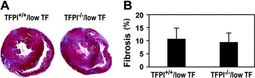 Figure 7. Cardiac fibrosis in low-TF mice with different levels of TFPI. Mice were euthanized at 6 months of age and hearts analyzed for fibrosis by staining with Masson trichrome. (A) Representative cross sections. Normal myocardium stains red and fibrotic tissue stains blue. (B) Quantitation of the fibrosis was determined using NIH Image Software. Data are presented as mean plus or minus SD from 8 TFPI+/+/low-TF mice and 7 TFPI–/–/low-TF mice.