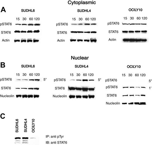 Figure 4. Cytoplasmic and nuclear accumulation of pSTAT6 in response to IL-4 stimulation of GCB-like and ABC-like DLBCL cell lines. GCB-like (SUDHL6, SUDHL4) and the ABC-like (OCILY10) cell lines were stimulated for 15, 30, 60, and 120 minutes with IL-4 (100 U/mL) and amount of pSTAT6 was assessed by immunoblotting of the cytoplasm (A) and nuclear extracts (B). These experiments were repeated 3 times. Exposure time of every blot is indicated (5 seconds or 1 minute). (C) Nuclear extracts of GCB-like (SUDHL6, SUDHL4) and ABC-like (OCILY10) cell lines stimulated with IL-4 for 1 hour were immunoprecipitated (IP) with anti-phospho-Tyr antibody and immunoblotted (IB) with anti-STAT6 antibody.