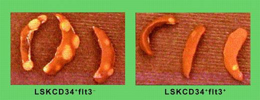 Distinct CFU-S and radioprotective potentials of LSKCD34+flt3–and LSKCD34+flt3+ ST-HSCs. See the complete figure in the article beginning on page 2717.