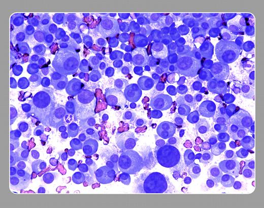 Peter Maslak, Memorial Sloan-Kettering Cancer Center