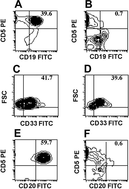 Figure 1. Anti-B-CLL reactivity of anti-third-party CTLs. On day 2 or 3 following bone marrow transplantation (BMT) from a SCID donor, chimeric mice were infused intraperitoneally with 100 to 150 × 106 PBMCs from patients with B-CLL (A,B,E,F) or AML (C,D). On days 4 to 10, some of the leukemia recipients were infused intraperitoneally with 10 × 106 to 15 × 106 allogeneic (B,D) or autologous (F) CTLs. One week later, peritoneal lavages from each individual mouse were tested for the presence of B-CLL or AML cells by FACS analysis. A representative experiment is shown. Numbers in graphs represent percent of cells in the upper-right quadrant (double positive cells).