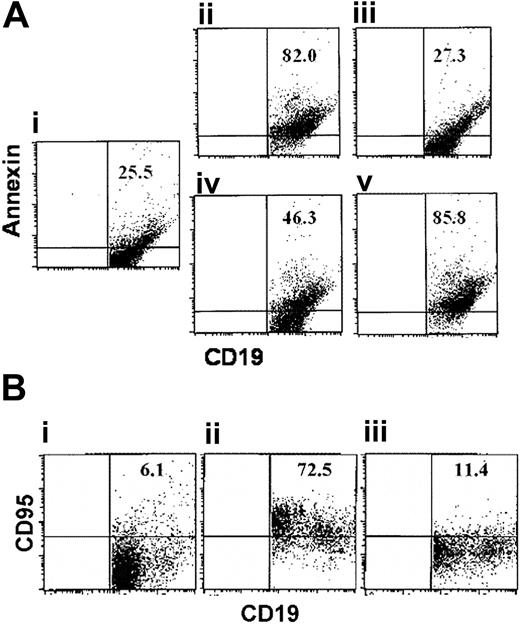 Figure 8. B-CLL killing by anti-third-party CTLs is not inhibited by CD95/CD95L blockade. (A) B-CLL cells (2.5 × 106) obtained from patients in stage IV were cultured alone (i) or with 5 × 105 allogeneic anti-third-party CTLs in the absence (ii) or presence of contact inhibition by means of incubation in transwell plates (iii), preincubation with LFA-1-blocking antibodies (iv) or following preincubation of B-CLL cells with anti-CD95-blocking Ab (v). Three days later, different wells were sampled and stained with the corresponding fluorescent Abs. Subsequently, cells were tested for apoptosis by annexin staining, as described in “Materials and methods.” A representative experiment is shown. (B) B-CLL cells (2.5 × 106) obtained from patients in stage IV were cultured alone (i) or with 5 × 105 allogeneic anti-third-party CTLs in the absence (ii) or presence (iii) of anti-CD95-blocking Ab. Three days later, different wells were sampled and stained with the corresponding fluorescent Abs. A representative experiment is shown. Numbers in graphs represent percent of cells in the upper-right quadrant (double positive cells).
