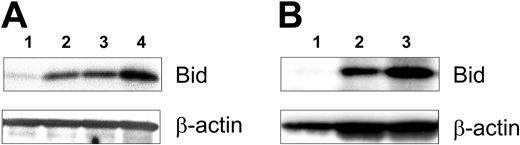 Figure 2. Time course of bid expression after CD40 ligation on CLL B cells. In panel A the CLL cells were cocultured 1 day with HeLa cells or HeLa-CD154 that expressed the CD40 ligand. The CLL cells were separated from the adherent HeLa cells, cultured separately, and then used to prepare whole-cell lysates. Forty micrograms of cell lysate was applied to each lane of a polyacrylamide gel for immunoblot analyses with anti-Bid (top row) or anti–β-actin (bottom row), as indicated on the right side of the figure. The different lanes are of lysates prepared from CLL cells cultured for 1 day after coculture with HeLa cells (lane 1) or for 1 day (lane 2), 2 days (lane 3), or 4 days (lane 4) after coculture with HeLa-CD154 cells. In panel B, CLL cells were isolated from a patient before (lane 1), 1 day after (lane 2), or 14 days after (lane 3) infusion of 1 × 109 Ad-CD154–transduced autologous leukemia cells, as described.1 Forty micorgrams of cell lysate was applied to each lane for immunoblot analysis, as described in panel A.