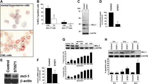 Figure 1. Expression of MCL-1 in primary CML cells and CML-derived cell lines. (A,B) Immunocytochemistry performed with bone marrow mononuclear cells (BMMCs) and an antibody against MCL-1. (A) A typical staining result in normal BMMCs (top) and BMMCs in a patient with CML (bottom). An Olympus BX50 microscope (Olympus, Tokyo, Japan) was used; magnification, × 400; camera, Olympus DP11 (Olympus); software, Adobe Photoshop (Adobe Systems, San Jose, CA). (B) Semiquantitative analysis of immunostaining data (percentage of MCL-1++ cells and of MCL-1+ cells) in patients with CML (n = 4, ▪) and normal BMMCs (n = 4, Co; □); results represent the mean ± SD from 4 donors; *P is less than .05. (C,D) Western blot analysis of expression of MCL-1 in primary CML cells after exposure to STI571 (1 μM) or control medium (control) for 24 hours. Panel C shows a representative experiment with molecular weight markers (kDa) and panel D a densitometric evaluation of MCL-1 expression (relative to β-actin) in primary CML cells with results (given as percent of control) representing the mean ± SD from 3 donors. (E,F) Northern blot analysis of expression of mcl-1 mRNA in primary CML cells exposed to control medium (control) or STI571 (1 μM) for 12 hours. Panel E shows a typical experiment in one donor and panel F a densitometric evaluation of data with results (given as percent of control) representing the mean ± SD from 3 donors; *P < .05. (G,H) Dose-dependent (G) and time-dependent (H) effects of STI571 on expression of the MCL-1 protein (top), cell viability (percent trypan blue-positive cells), and percentage of apoptotic cells (bottom) in K562 cells. Results represent the mean ± SD from 3 independent experiments. MCL-1 protein expression was determined by Western blotting; β-actin served as a loading control.