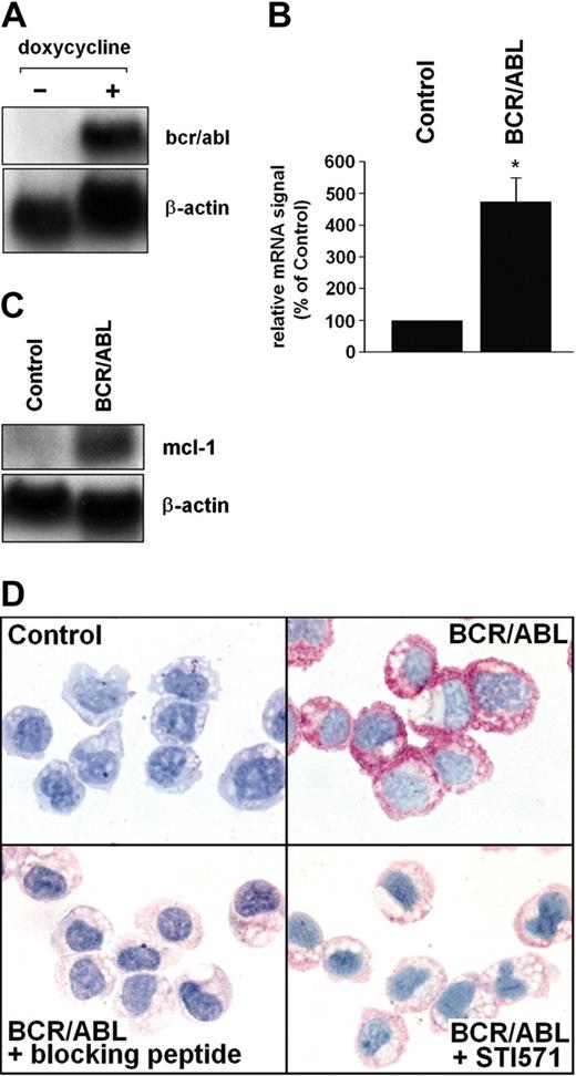 Figure 2. BCR/ABL-dependent expression of MCL-1 in Ton.B210-X cells. (A) Ton.B210-X cells were induced to express BCR/ABL by addition of doxycycline (1 μg/mL, 16 hours). Thereafter, RNA was subjected to Northern blotting. Expression of bcr/abl mRNA was determined using a c-abl-specific cDNA probe. The β-actin loading control is also shown. (B,C) Analysis of mcl-1 mRNA expression in Ton.B210-X cells after induction of BCR/ABL. Panel B shows a typical experiment and panel C a densitometric evaluation of data (corrected for β-actin) with results given as percent of control and representing the mean ± SD of 3 independent experiments; *P < .05. (D) Immunocytochemical detection of MCL-1 in unstimulated Ton.B210-X cells (control), Ton.B210-X cells after exposure to doxycycline (BCR/ABL), BCR/ABL+ Ton.B210-X cells stained with anti-MCL-1 antibody that had been preincubated with MCL-1-blocking peptide (BCR/ABL+ blocking peptide), and BCR/ABL+ Ton.B210-X cells preincubated with STI571 (1 μM) for 24 hours prior to staining with the anti-MCL-1 antibody (BCR/ABL+ STI571). An Olympus BX50 microscope (Olympus, Tokyo, Japan) was used; magnification, × 400; camera, Olympus DP11 (Olympus); software, Adobe Photoshop.