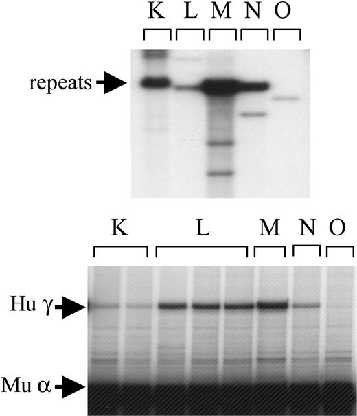 Figure 5. Analyses of structure and expression of construct HS-40/βpr/γ gene/HS5 in transgenic mice. Five lines (K-O) carrying this transgene were established. (Top) Structure analysis. (Bottom) RNA analysis. See the legend of Figure 2 for details.