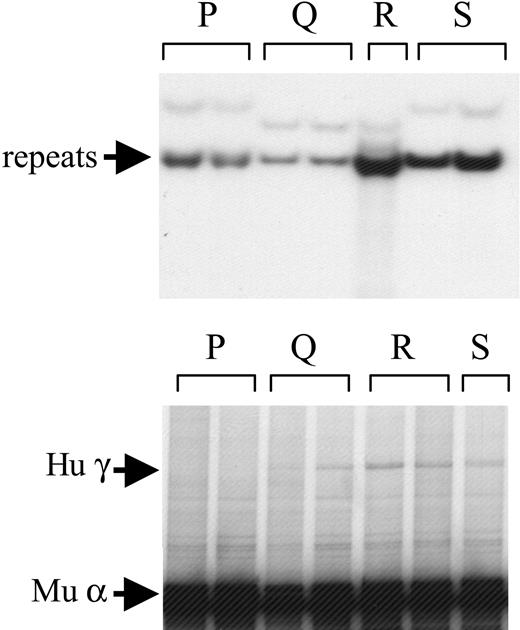 Figure 6. Analyses of structure and expression of the construct HS4/HS-40/ βpr/γ gene in transgenic mice. Four lines (P-S) carrying this transgene were established. (Top) Structure analysis. (Bottom) RNA analysis. See the legend of Figure 2 for details.