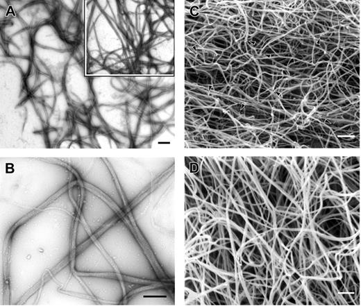 Figure 4. Transmission and scanning electron microscopy of Fg Philadelphia and normal control clot fibers. Clots were made under the same conditions as in Figure 2 with calcium. (A) Transmission electron micrograph of clot from fibrinogen Philadelphia at low magnification. Inset shows normal clot formed under similar conditions. Magnification bar = 1 μm. (B) Transmission electron micrograph of clot from fibrinogen Philadelphia at higher magnification, showing the details of fiber structure. Magnification bar = 0.5 μm. (C) Scanning electron micrograph of clot from fibrinogen Philadelphia showing the pattern of fiber branching, including fiber ends, with irregular branch points indicated by arrowheads. Magnification bar = 1 μm. (D) Scanning electron micrograph of control clot. Magnification bar = 1 μm.