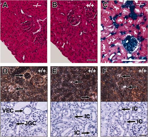 Figure 2. EPAS1 is expressed in renal interstitial cells. Representative kidney sections from hematoxylin and eosin–stained (A) EPAS1–/– (–/–) or (B) EPAS1+/+ (+/+) kidney (×40 fields) and (C) β-galactosidase–stained EPAS1–/– (–/–) kidney (×40 field). Dark-field (top) and bright-field images (bottom) of in situ studies performed on kidney samples from EPAS1+/+ mice after exposure to short-term continuous hypoxia (STCH) with probes specific for (D) and (E) EPAS1 or (F) Epo mRNA. The arrows indicate areas of prominent signal in vascular endothelial cells (VECs), juxtaglomerular complex cells (JGCs), or interstitial cells (ICs) within the kidney. The black bars in panel B and the white bar in panel C correspond to 100 μm; the black bar in panel F corresponds to 200 μm.