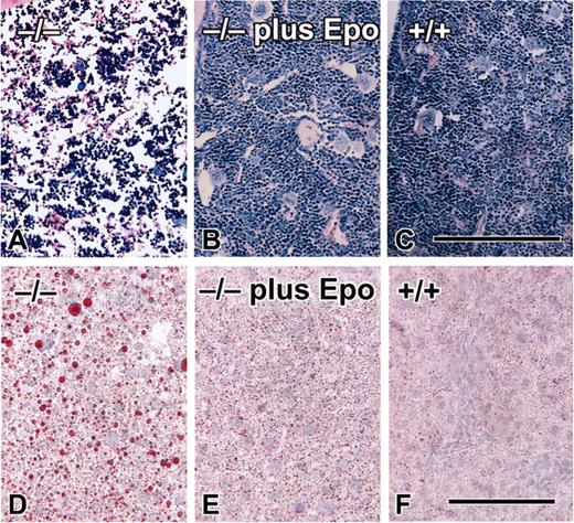 Figure 5. Erythropoietin treatment alters other aspects of the EPAS1–/– phenotype. Giemsa staining of bone marrow from representative (A) untreated (-Epo) EPAS1–/– (–/–), (B) erythropoietin-treated (+Epo) EPAS1–/– (–/–), or (C) EPAS1+/+ (+/+) mice (all images are ×20 fields, equivalent size). The black bar in panel C corresponds to 100 μm. Representative oil red O (ORO) staining of liver from (D) untreated (-Epo) EPAS1–/– (–/–), (E) erythropoietin-treated (+Epo) EPAS1–/– (–/–), or (F) EPAS1+/+ (+/+) mice (all images are ×20 fields, equivalent size). The black bar in panel F corresponds to 100 μm.