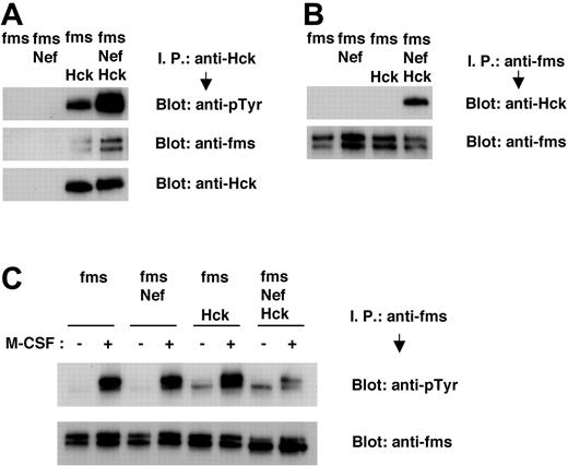 Figure 6. Nef causes tyrosine phosphorylation of Hck, constitutive association of Hck with M-CSF receptor complex, and inhibition in tyrosine phosphorylation of M-CSF receptor in 293T cells. (A-C) 293T cells were transfected with M-CSF receptor (c-fms) expression plasmid, alone or in combination with Nef or Hck expression plasmids. Total cell lysates were prepared and subjected to immunoprecipitation/Western blotting analyses. (C) Transfected 293T cells were treated in the absence or presence of M-CSF for 2 minutes before lysis. (A) Immunoprecipitates with anti-Hck antibody were analyzed with antiphosphotyrosine (pTyr) antibody (top) or anti-M-CSF receptor antibody (middle). The blot shown in the bottom panel, in which the immunoprecipitates were analyzed with anti-Hck antibody, is a loading control experiment for upper panels. (B) Immunoprecipitates with anti-M-CSF receptor antibody were analyzed with anti-Hck antibody (top). The blot shown in the bottom panel, in which the immunoprecipitates were analyzed with anti-M-CSF receptor antibody, is a loading control experiment for the top panel. (C) Immunoprecipitates with anti-M-CSF receptor antibody were analyzed with anti-pTyr antibody (top). The blot shown in the bottom panel, in which the immunoprecipitates were analyzed with anti-M-CSF receptor antibody, is a loading control experiment for the top panel.