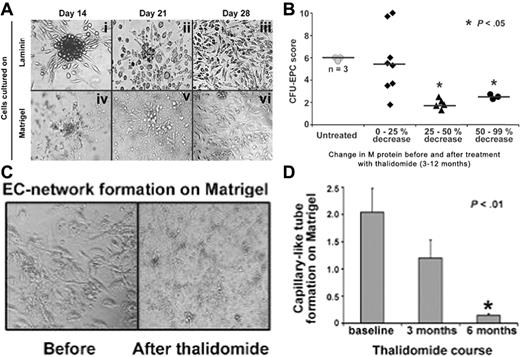 Figure 3. In vitro studies of endothelial progenitor cell (EPC) colony formation, growth, and capillary-like network formation before and after thalidomide. (A) Peripheral blood mononuclear cells were cultured in laminin-coated 6-well plates (i-iii) or in matrigel-coated 48-well plates (iv-vi). Colonies were quantitated 14 days after plating. Phase contrast micrographs of cultures from an MM patient were examined at the indicated time points: (i) an EPC colony characterized by a central cluster of rounded cells surrounded by radiating, thin, flat, elongated cells; (ii) smaller colonies at the indicated time point and a reciprocal increase in EC outgrowth; (iii) confluent expansion of endothelial cells; (iv) colony growth and tube formation on matrigel; (v) progression of tube formation; and (vi) EC network formation. Original magnification × 200. (B) Colony formation on laminin from patients with MM, stratified by change in M protein levels after treatment with thalidomide. P was determined by nonpaired analysis using Student t test. (C) Comparison of capillary-like network formation by EPCs from a patient before and after 3 months of treatment with thalidomide. The patient's serum M protein levels had decreased by 75% compared to pretreatment (not shown). PBMCs were grown on matrigel. Original magnification × 200. (D) Time course of thalidomide's effect on EC network formation. Bars represent mean ± SD of 3 patients' capillary-like tube formation scores which were determined sequentially at the indicated times during treatment with thalidomide. Tube formation score was assigned by phase contrast microscopy as described in “Patients, materials, and methods.” Mean of triplicate wells from each patient at indicated times was assigned as their score.