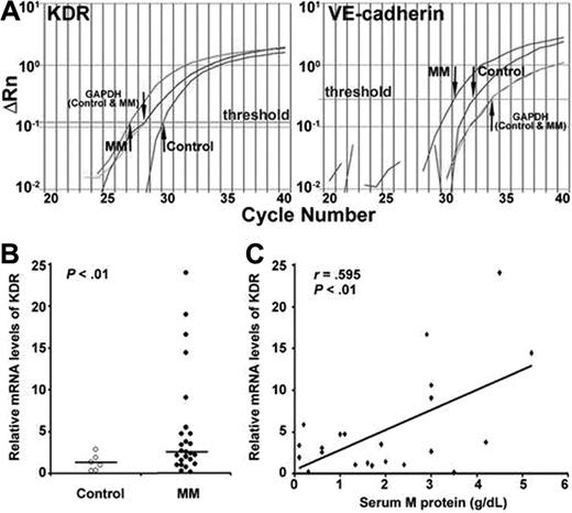 Figure 5. Quantitative measurement of KDR and VE-cadherin gene expression in MM using real-time RT-PCR. The cDNA of PBMCs from patients with MM or controls was used to amplify KDR, VE-cadherin, and GAPDH in real-time PCR reactions. An optimized threshold line was determined in the range of linear amplification to compare cycle number in different samples. The expression of KDR and VE-CADHERIN was calculated by the comparative threshold cycle method. Reproducibility of this method was confirmed by repetition of each experiment once using frozen aliquots of the same mRNA extracted within 6 hours of collection of PBMCs from subjects and stored at -20°C for 4 weeks. (A) Representative amplification plots for KDR (left) or VE-cadherin (right) expression in PBMCs from an MM patient and a control subject; GAPDH amplification was used as an internal control. While GAPDH levels for both MM and control are comparable, indicating the same amount of cDNA used in each reaction, expression of KDR (CT = 30.2 for control, CT = 26.3 for MM) and VE-cadherin (CT = 32.9 for control, CT = 31.1 for MM) were different. Arrows indicate the CT values. (B) Relative mRNA expression of KDR is shown for patients (filled circles) and controls (open circles). (C) KDR mRNA level is positively correlated with concurrently determined serum M protein levels. The association between KDR mRNA and M protein was evaluated by Pearson r.