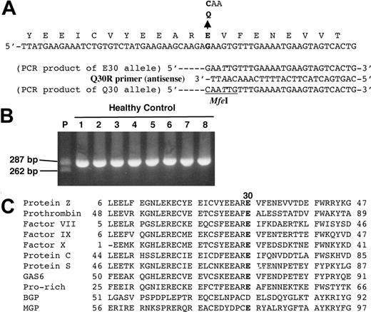 Figure 1. E30Q mutation identified in patient's PZ gene. (A) The normal nucleotide sequence of the PZ gene is shown at the top and a nucleotide substitution in exon II is indicated by a bold letter. A primer for PCR-RFLP analysis, the Q30R primer, was designed with 1 base mismatch (in italics) to generate an MfeI endonuclease restriction site in a PCR product from the mutant allele (bottom). (B) PCR products obtained from the patient (P) and healthy controls (1-8) were applied to agarose gel electrophoresis after MfeI digestion. Only the mutant Q30 allele was cleaved into 262–base pair (bp) and 25-bp fragments, although the latter is too small to detect. (C) Alignment of the amino acid sequences of Gla domains among vitamin K–dependent proteins. The position of E30 in PZ is shown in bold. GAS6 indicates growth arrest specific 6; BGP, bone Gla protein; MGP, matrix Gla protein.