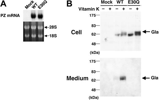 Figure 2. Expression of wild-type and E30Q mutant PZs in BHK cells. (A) Northern blotting of PZ mRNA obtained from BHK cells transfected with either WT or E30Q PZ vectors. The amount of mRNA for the E30Q mutant was comparable to that of the WT, as shown by RNA bands at the bottom. (B) Stably transformed BHK cells were incubated for 24 hours in the absence or the presence of 5 μg/mL vitamin K. Culture medium was directly subjected to SDS-PAGE under nonreducing conditions, followed by Western blotting using an anti–human PZ antibody. Protein (10 μg) of cell lysates was also analyzed by SDS-PAGE under reducing conditions and Western blotting. Mutant PZ was never detected in the culture medium, while WT PZ was readily found only when cultured in the presence of vitamin K. Note that the upper band (Gla) appeared inside cells only in the presence of vitamin K.
