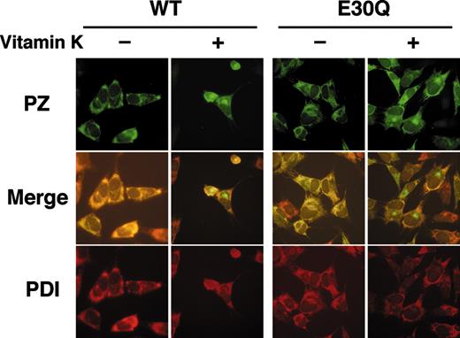 Figure 5. Immunofluorescent microscopy of cells stably expressing PZ. Cells were first cultured for 24 hours in the presence or the absence of vitamin K. After fixation and permeabilization, cells were incubated with a rabbit anti–human PZ antibody, followed by reaction with a FITC-labeled anti–rabbit IgG (top). The same cells were also stained with an anti-PDI monoclonal antibody coupled with a rhodamine-labeled anti–mouse IgG (bottom). Merged images are shown in the middle. Note that both the WT and Q30E PZs were detected in the Golgi apparatus only in the presence of vitamin K. Fluorescence was detected as described in the methods section (magnification × 40).
