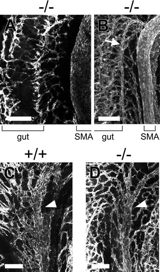 Figure 2. CXCL12 is essential for the formation of interconnecting vessels between SMA and the primary capillary plexus surrounding the primitive gut but not the venous network. Whole-mount immunohistochemical analysis of midgut loops from wild-type or CXCL12–/– embryos using pan-endothelial marker PECAM-1. Images were collected by standard confocal microscopy and used to build the 3-dimensional projection shown here. (A) The interconnecting vessels between SMA and the primary capillary plexus surrounding the primitive gut are almost absent in E12.5 CXCL12–/– embryos. (B) A collateral (arrow) arises from SMA around the apex of the midgut loop in the mutants. (C, D) There is no significant difference in SMV (arrowheads) and the venous network arising from SMV between E12.5 wild-type (C) and CXCL12–/– (D) embryos. Bars, 100 μm.