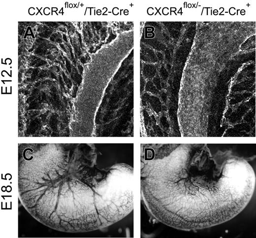Figure 6. CXCR4 expressed in endothelial cells is required for vascularization of the gastrointestinal tracts. Whole-mount PECAM-1 staining of E12.5 midgut loops (A, B) and E18.5 stomachs (C, D). (A, B) Images were collected by standard confocal microscopy and used to build the 3-dimensional projection shown here. The interconnecting vessels between SMA and the primary capillary plexus surrounding the primitive gut seen in CXCR4flox/+/Tie2-Cre embryos (A) are absent in CXCR4flox/–/Tie2-Cre embryos (B). (C, D) Whole-mount view of the stomach. The large vessels distributed to the surface of the stomach seen in CXCR4flox/+/Tie2-Cre embryos (C) are absent in CXCR4flox/–/Tie2-Cre embryos (D).