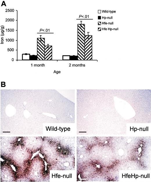 Figure 1. Liver iron loading. (A) Iron concentrations in liver samples from 1- and 2-month-old wild-type (□), Hp-null (▪), Hfe-null (▧), and HfeHp double-null F2 mice (▨). Results are expressed as mean ± SEM; n = 12 for each group. There was a tendency to lower liver iron content in Hp-null mice compared with wild-type mice (particularly at 1 month) but the difference was not statistically significant. There were significant differences between Hfe-null and wild-type mice (P < .001), Hfe-null and Hp-null mice (P < .001), and Hfe-null and Hfe and Hp compound mutant mice (P < .01) at both 1 and 2 months of age. (B) Liver sections from wild-type, Hp-null, Hfe-null, and Hfe and Hp compound mice stained with Perls reaction. Note the reduction in periportal iron deposits in the HfeHp double-null mouse compared with the Hfe-null mouse. Bar = 100 μm.