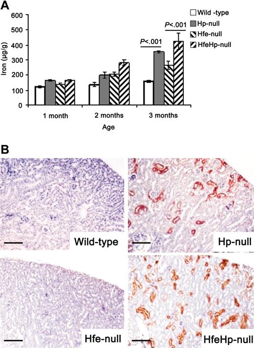 Figure 2. Kidney iron loading. (A) Iron concentrations in kidney samples from 1-, 2-, and 3-month-old wild-type, Hp-null, Hfe-null, and HfeHp double-null F2 mice. Symbols indicate same groupings as in Figure 1. Results are expressed as mean ± SEM; n = 10 for each group. There was a tendency for higher kidney iron content in Hp-null and HfeHp-null mice compared with wild-type and Hfe-null mice, respectively, at 1 and 2 months of age but the difference was not statistically significant. There were strongly significant differences between Hp-null and wild-type mice (P ≤ .001) and between HfeHp-null and Hfe-null mice (P ≤ .001) at 3 months of age. (B) Kidney sections from wild-type, Hp-null, Hfe-null, and Hfe and Hp compound mice stained with Perls reaction. Note iron deposits in proximal tubular cells in Hp-null and HfeHp-null mice. Bar = 100 μm.