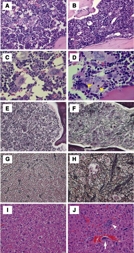 Figure 6. Histologic examination of transgenic mouse bone marrow, spleen, and liver. The right column (A,C,E,G,I) and the left column (B,D,F,H,J) represent histologic examination of wild-type littermates and BACH1 transgenic mice, respectively. The photomicrographs in panels A-D show HE staining of bone marrow specimens. Yellow arrowhead in panel D indicates emperipolesis of granulocytes that was specifically observed in megakaryocytes from transgenic mice. (E-F) Silver impregnation staining of bone marrow. (G-H) Silver impregnation staining of spleen. Aggressive fibrosis was recognized in both tissues derived from transgenic mice. (I-J) HE staining of liver sections. Erythroid islets (white arrowhead in panel J) and megakaryocytes (white arrow in panel J) were observed in the sinusoids of the livers derived from transgenic mice. Representative staining sections were prepared using 4-month-old transgenic mice of line 705 and their corresponding wild-type littermates. Original magnifications × 200 (A-B,E-J) and × 400 (C-D).