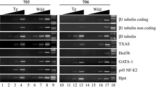 Figure 7. Semiquantitative RT-PCR analysis of p45 target genes in megakaryocytes derived from BACH1 transgenic mice. Expression of β1-tubulin, β5-tubulin, TXAS, Hsd3b, GATA-1, p45, and Hprt was analyzed by RT-PCR using RNA extracted from cultured megakaryocytes derived from fetal liver cells of wild-type mice and their transgenic littermates. To ensure linearity of PCRs, 10-fold serial dilutions of template cDNA were used. Typical photographs from 3 independent experiments are shown.