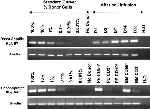 Figure 2. In vivo expansion of haploidentical NK cells. After establishing a standard curve between donor and recipient using the informative HLA-B7 allele, postinfusion samples were analyzed in a patient receiving Hi-Cy/Flu. In contrast to patients receiving Lo-Cy/mPred, Hi-Cy/Flu not only increased the persistence of donor cells but also facilitated in vivo expansion as demonstrated by the increased band density beyond day 2 (D2) (β-actin control for equal sample loading). In another patient, after establishing HLA-B31 as an informative allele, NK cells, T cells, and B cells were sorted from blood (PB) and marrow (BM). From this patient, essentially 100% of NK cells, but not T or B cells, were of donor origin.