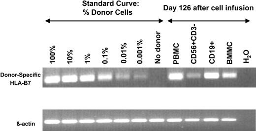 Figure 5. EBV reactivation induced in vivo expansion of haploidentical B cells. Using the informative HLA-B7 allele, blood and bone marrow mononuclear cells (BMs) were evaluated in a patient who developed fevers, hemophagocytosis, and EBV reactivation 126 days after haploidentical NK-cell infusions and about 226 days following umbilical cord blood transplantation. PB containing 5% CD56+/CD3– NK cells and 68% CD19+ B cells were sorted to purity (documented by postsort analysis) and their origin was evaluated. Haploidentical NK cells were minimally present in the 120-day sample, unlike that observed at earlier time points (14 days) after infusion. However, most of the EBV-driven B cells were from the HLA-B7 haploidentical NK-cell donor.
