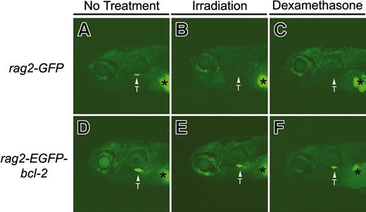 Figure 2. Thymocytes from larval 8-day-old rag2-EGFP-bcl-2 transgenic fish are resistant to irradiation- and dexamethasone-induced apoptosis. Fluorescent microscopic analysis of 8-day-old rag2-GFP transgenic fish without treatment (A), 2 days after irradiation (15 Gy; B), or 3 days after dexamethasone treatment (250 ÎĽg/mL; C). Eight-day-old rag2-EGFP-bcl-2 transgenic fish without treatment (D), 2 days after irradiation (E), or 3 days after dexamethasone treatment (F). Location of the thymus is denoted by arrows and labeled (T). Asterisk denotes autofluorescence of the swim bladder. Fish oriented with anterior to the left and dorsal to the top.