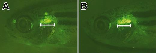 Figure 4. The thymus is expanded in rag2-EGFP-bcl-2 transgenic fish. Fluorescent microscopic analysis of 52-day-old rag2-EGFP-bcl-2 transgenic fish having enlarged thymi (B) when compared with age- and sex-matched rag2-GFP fish (A). Bar denotes length of the ventral-most portion of the thymus in rag2-EGFP-bcl-2 fish. Fish oriented with anterior to the left and dorsal to the top.