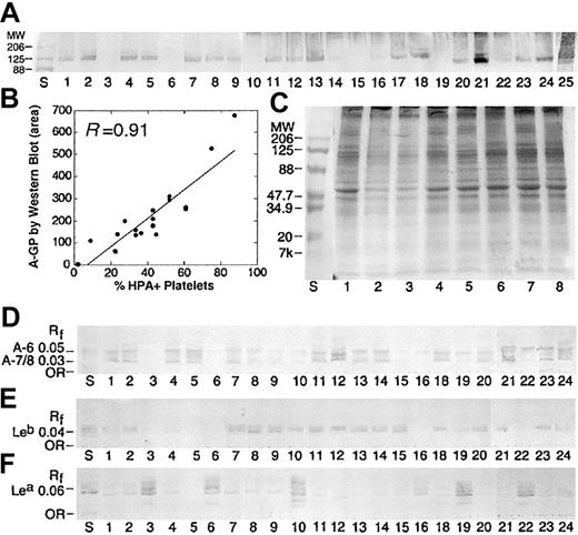 Figure 3. Blood group A expression on platelet GPs and GSLs is dictated by A1 subtype and is independent of Lewis phenotype. (A) Western blot results for 25 apheresis platelet donors, stained with anti-A (MoAb Birma1). Positive staining was observed in A1 but not A2 individuals. Strong staining was observed in 2 ABH-HPX donors (lanes 21 and 25). (B) The intensity of HPA staining on platelet membranes (% HPA+ platelets) is related to the intensity of GP-A staining by Western blot, as determined by scanning densitometry (area), where y = 46.5 + 6.43x, R = 0.91. (C) Platelet GPs separated by SDS-PAGE and stained with Coomassie Brilliant Blue. Lane numbers refer to the same donor samples shown in panel A. Lane S, molecular weight standards. (D-F) Isolated neutral GSLs from the same donors in panel A, immunostained with anti-A (D), anti-Leb (E), and anti-Lea (F). Solvent C-M-W 65:25:4 (vol/vol). Rf indicates relative mobility.