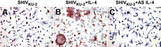 Figure 2. Viral protein staining in SHIVKU-2–infected rhesus MDMs after treatment with IL-4 protein and AS IL-4 ODN. MDM cultures were grown on chamber slides, inoculated with SHIVKU-2 for 4 hours at 37°C, washed, and untreated (A) or then treated with either rmIL-4 (B) or AS IL-4 (C) for 48 hours. Cells were then fixed and immunostained using anti-Gag p27 antibody.