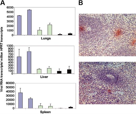 Figure 7. Viral RNA load in AS IL-4 DNA treated and untreated SHIV-infected macaques as seen by real-time RT-PCR and immunohistochemistry. (A) Viral RNA levels in the lungs (top), liver (middle), and spleen (bottom) in SHIV89.6P-infected macaques (blue bars); viral RNA in infected macaques given a single dose of AS IL-4 (green bars); and viral RNA in the animals receiving 2 injections of the AS DNA (black bars). Viral gag mRNA/million HPRT ratios obtained after real-time RT-PCR are presented. RNA was extracted from 3 different regions of each tissue and analyzed individually. (B) p27 Staining in the spleen sections of control (top) and treated animals (bottom).