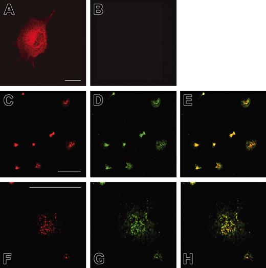 Figure 5. Localization of Rap1GAP2 in transfected COS-1 cells and in platelets. COS-1 cells transiently transfected with Rap1GAP2 (A) and nontransfected control cells (B) were stained with an antibody specific for Rap1GAP2. Rap1GAP2 localized predominantly to cytosolic and perinuclear structures in transfected cells. Nontransfected control cells were not labeled, indicating specificity of the antibody. (C-H) Human platelets spread on glass were double labeled with antibodies specific for Rap1GAP2 (C, F) and Rap1 (D, G, and merged images E, H). (F-H) In the center of each panel, a single large, spread platelet is shown. Both Rap1GAP2 and Rap1 proteins partially colocalized in central vesicular structures. Shown are examples of experiments performed at least 5 times. Bar = 10 μM.