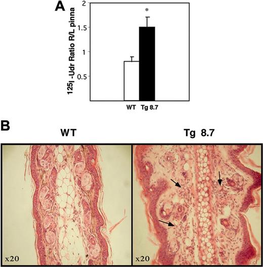 Figure 7. DTH responses in WT and TPCR transgenic mice. (A) Mice were directly challenged with the antigen (DNFB) in the right pinna and accumulation of infiltrating 125I-UdR–labeled mononuclear cells into both ears (R/L ratio) was estimated 26 hours latter. The results shown represent 2 different experiments; 5 mice were tested per group. Error bars represent the standard deviation of replicates. *P < .005. (B) Histologic sections of the right pinna of Tg8.7 and WT mice. Pinnae were fixed in buffered formalin, cut, and stained with hematoxylin and eosin. Note subepidermal and epidermal infiltration of inflammatory cells, mainly neutrophils, as well as lymphoid and plasma cells in the transgenic pinnae (arrows).
