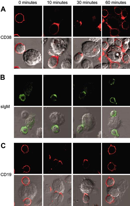 Figure 1. CD38/CD31 crosstalk induces membrane remodeling of the CD38 receptor and of the BCR/CD19 complex. B-CLL cells purified from 5 patients (nos. 2, 4, 6, 7, and 9) were exposed to L-CD31+ transfectants for the indicated time intervals. Cells were then fixed and stained for CD38 (A) and CD19 (C) using a Texas Red–conjugated secondary antibody. sIgM molecules (B) were highlighted by means of a FITC-conjugated antibody. The cells were observed with an Olympus 1 × 71 confocal microscope (oil immersion × 60 objective), and the images were acquired using the FluoView software. Conjugates were identified by direct observation of cell morphology under differential interference contrast.