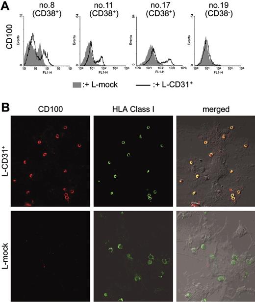 Figure 3. CD38/CD31 crosstalk up-modulates CD100 expression in a subset of B-CLL cells. B-CLL cells were purified from 3 CD38+ and 1 CD38– patients (nos. 8, 11, and 17, and no. 19, respectively) and cocultured with murine irradiated L-CD31+ or L-mock fibroblasts previously plated on glass coverslips. After 5 days, non–tightly adhering cells were collected from culture and stained for CD100 expression (A). The remaining conjugates were fixed and stained with an anti-CD100 mAb (BB18) followed by a Texas Red–conjugated secondary antibody. Counterstaining was performed with a FITC-conjugated anti–HLA class I mAb. The coverslips were mounted on slides and the cells observed using an Olympus 1 × 71 confocal microscope (oil immersion × 60 objective), and the images acquired using the FluoView software (B).